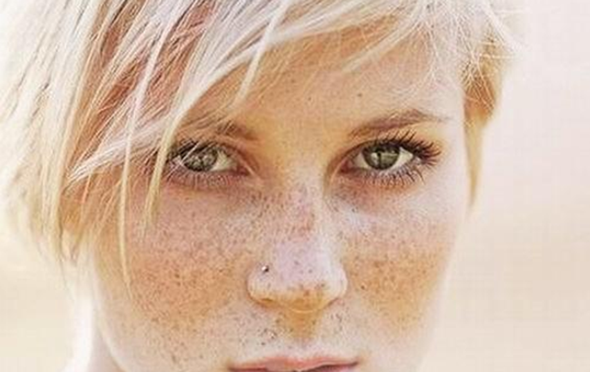 Why do spots appear on the face?